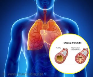 Quiz on Chronic Obstructive Pulmonary Disease (COPD)