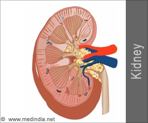 Dialysis Efficiency (Kt/V) Calculator