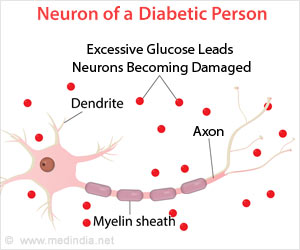 Test Your Knowledge on Diabetic Nerve Pain | Diabetic Neuropathy