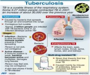 Screening Air Travelers for TB A Waste: Study