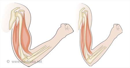 Ureteroscopy - Overview