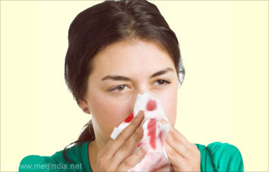 Nose Bleed / Epistaxis - Causes - Symptom - Treatment - Prevention