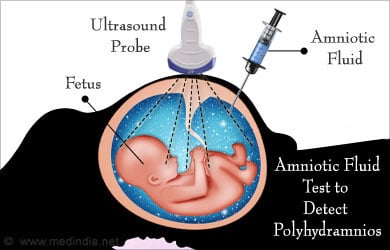 strip test for amniotic fluid