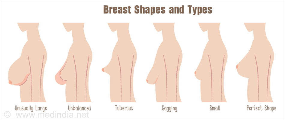 Tits Tubular Deformed Breasts - Boob community saggy type - Hot Nude