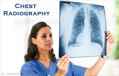 Chest X Ray Radiography