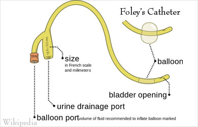 Urinary Incontinence - Symptom Evaluation