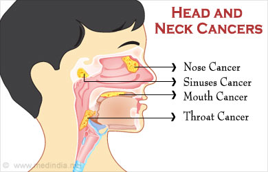 Head and Neck Cancers - Types, Risk Factors, Symptoms, Diagnosis ...