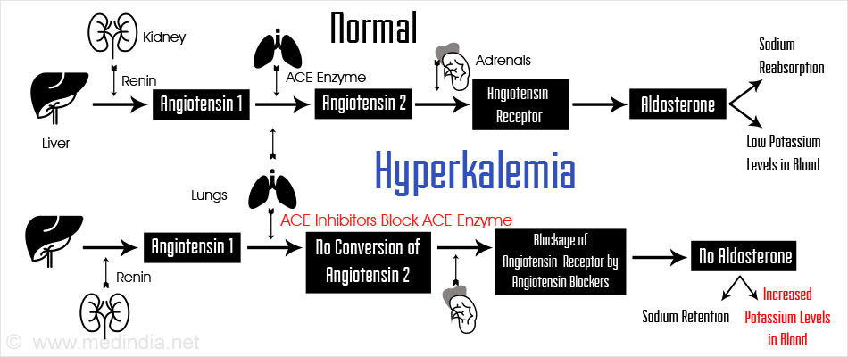 body problem 3 Potassium  High Levels  Hyperkalemia Induced Drug