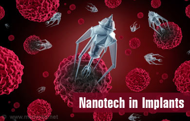 Use of Nanotechnology in Healthcare - Brain, Breast, Dental, Orthopedic ...