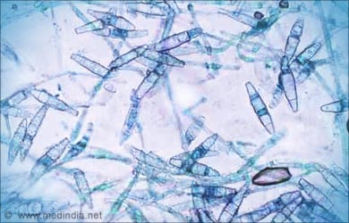 ringworm under microscope