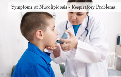 Mucolipidoses - Types, Symptoms, Diagnosis, Treatment, Prevention