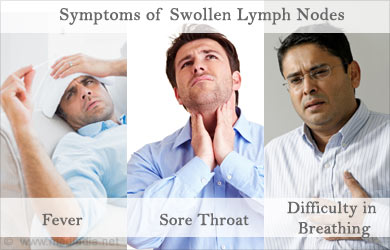 Swollen Lymph Nodes | Lymphadenopathy - Causes, Symptoms, Diagnosis ...