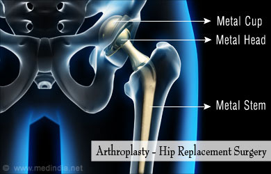 Orthopedic Surgery and Procedures